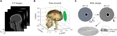Binary acoustic metasurfaces for dynamic focusing of transcranial ultrasound